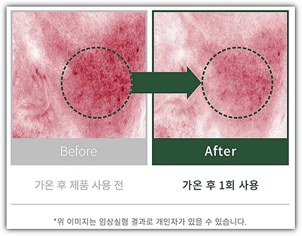 시카마누 붉은기 진정 테스트 결과