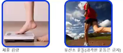 체중감량과 유산소운동 이미지