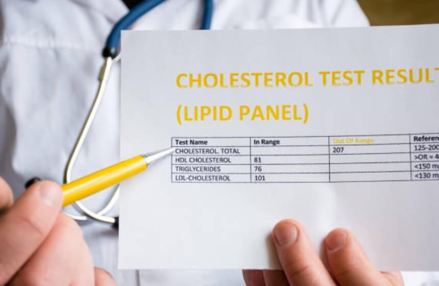 콜레스테롤여성수치