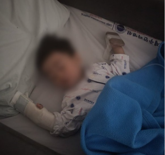 손가락 절단 당한 15개월아이가 붕대를 감고 자고 있는 모습