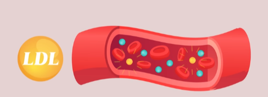  고지혈증 약 없이 건강한 혈관 만드는 법 