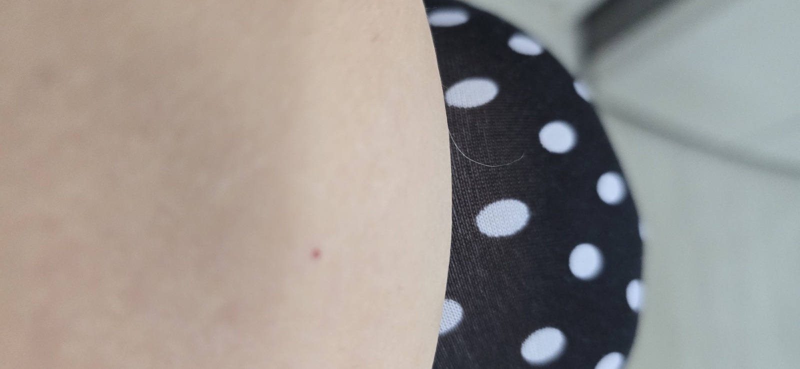 몸에 난 하얀 털