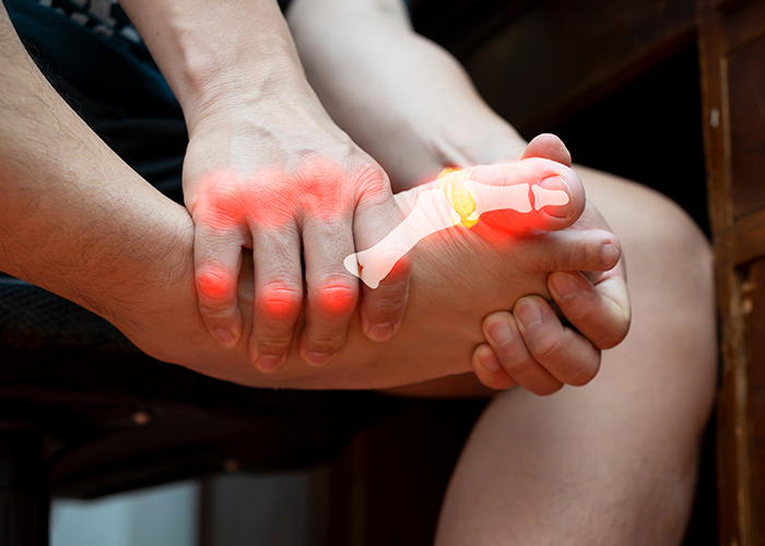 통풍증상이 있는 발을 잡고 있는 이미지