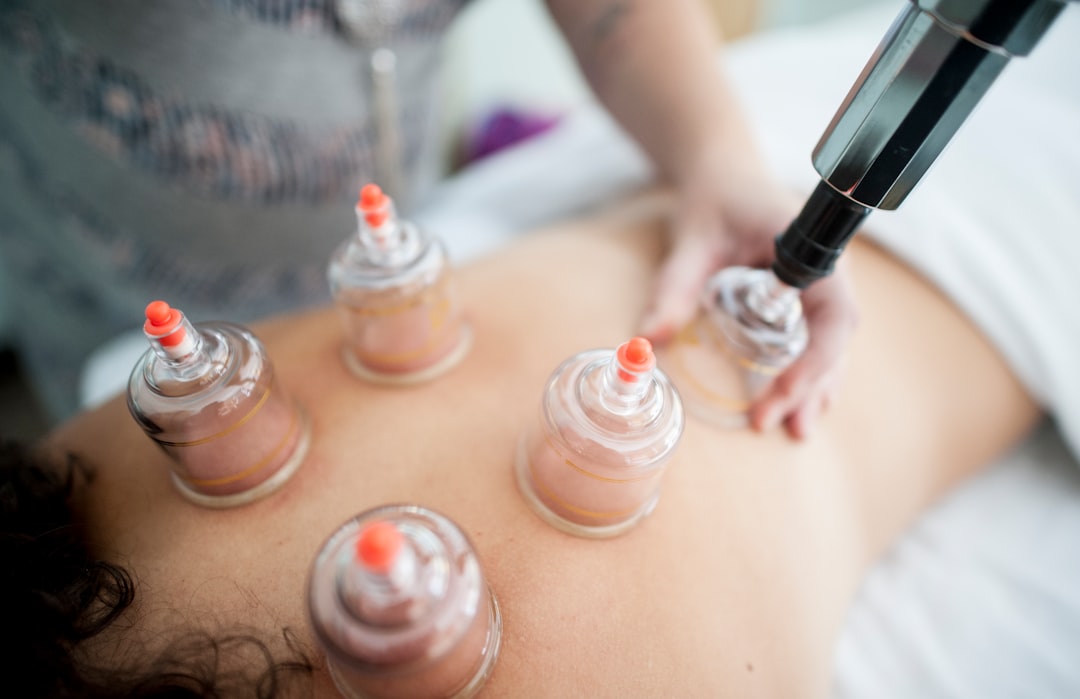 Acupuncture