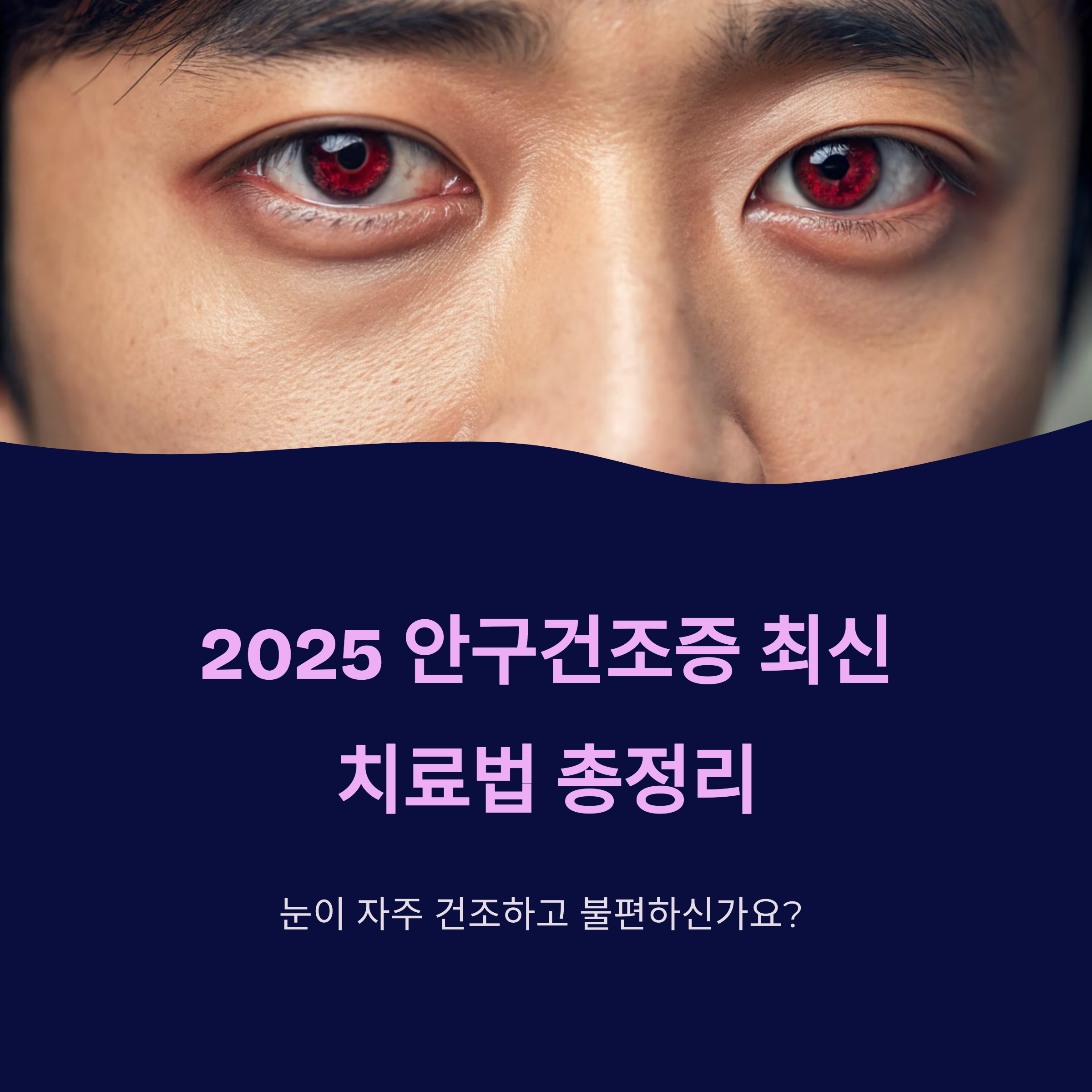 안구건조증