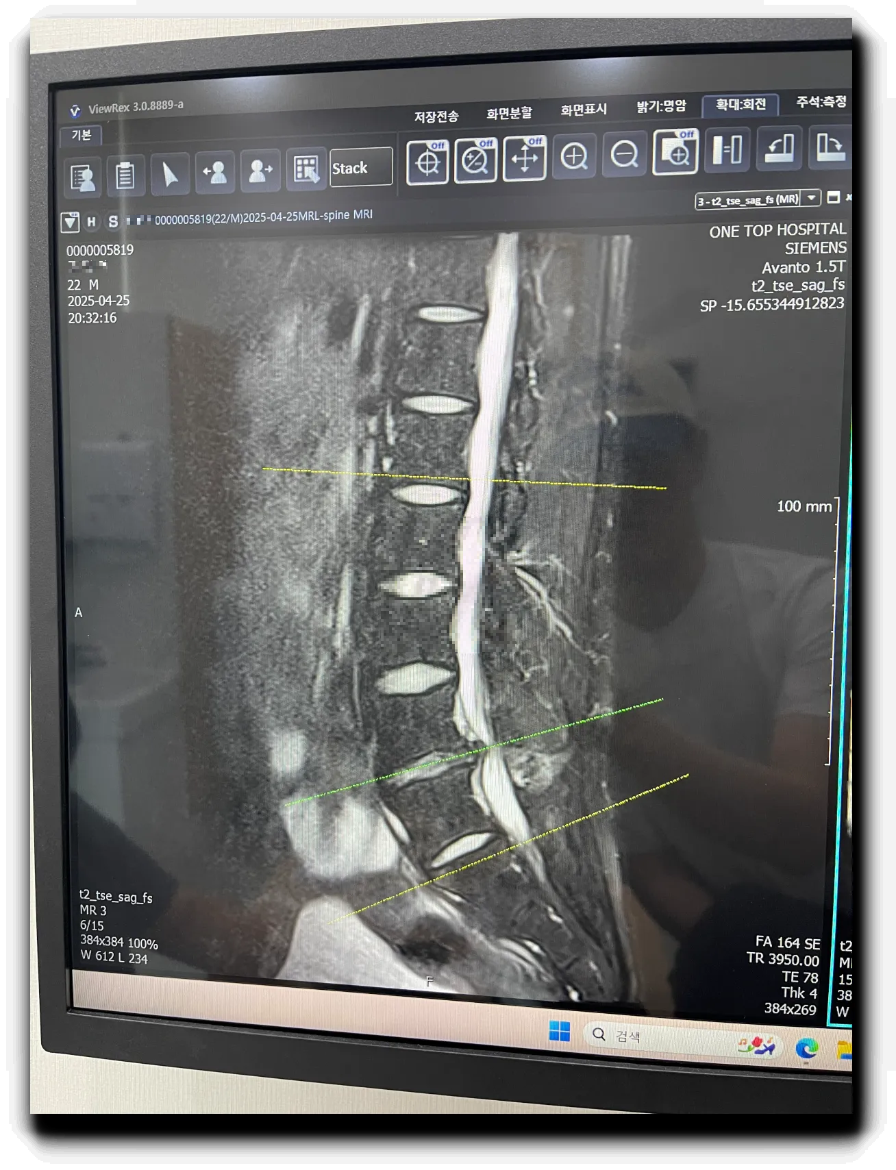 4월-25일-MRI-사진-전면