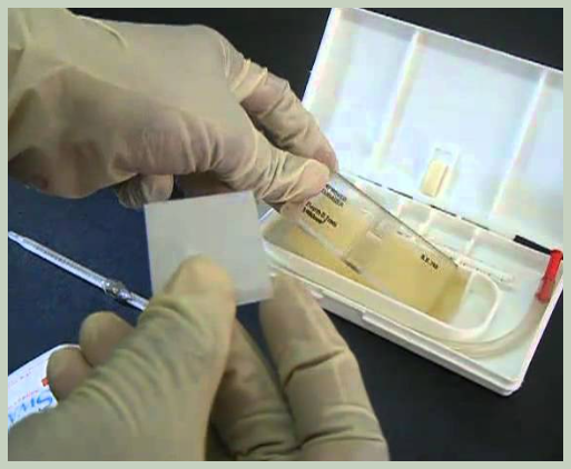 백혈구 수치 검사 방법