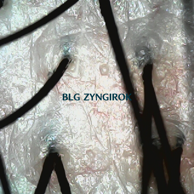 피나모아 복용 25주차 뒷머리 부분 두피 사진 모습이다.