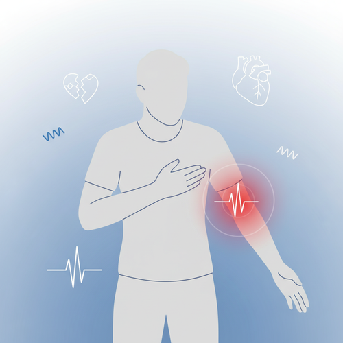 놓치면 안 돼요! 심근경색의 주요 전조증상들