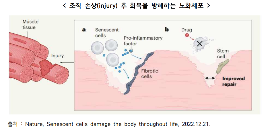 조직 손상과 노화세포