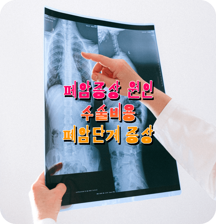폐암 증상 원인 진단방법