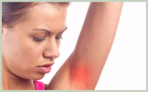 겨드랑이 가려움증 원인과 치료