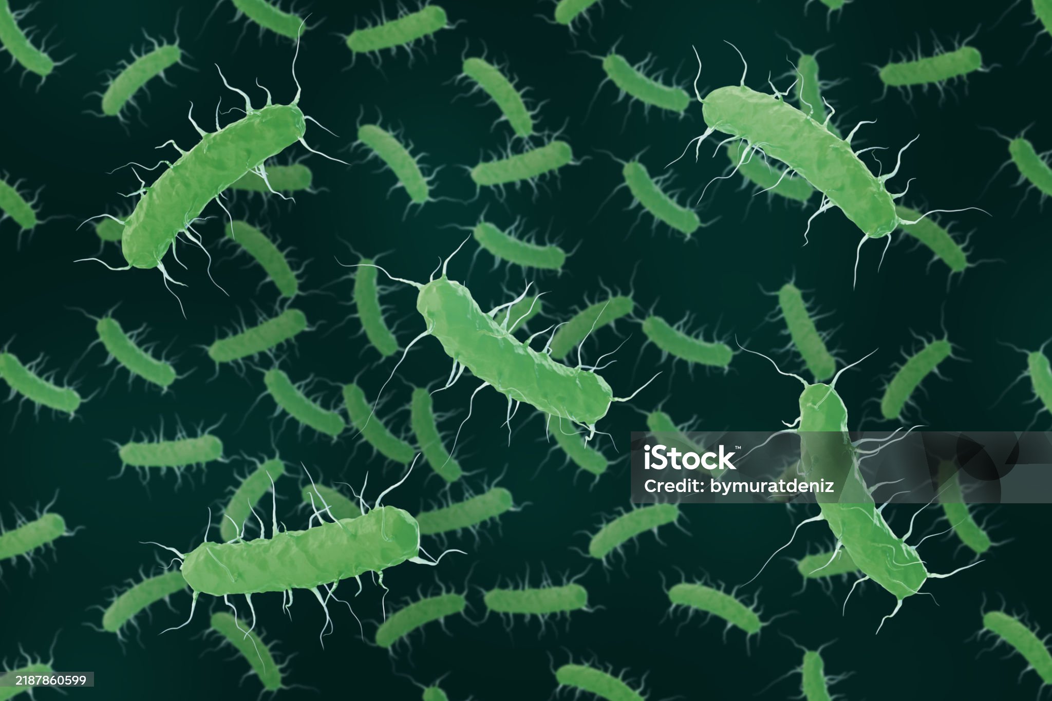 복막염-관련-사진