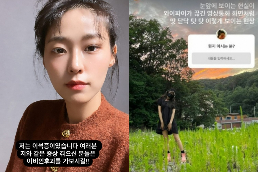 이석증 자가 치료