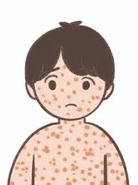 피부발진의 종류