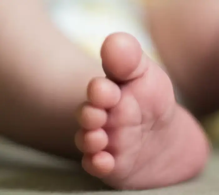 아기 수족구 원인