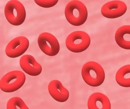 빈혈 치료방법 진단기준 합병증