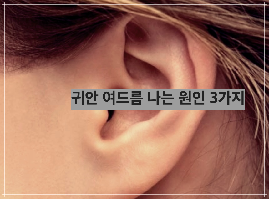 귀안 여드름 나는 원인 3가지