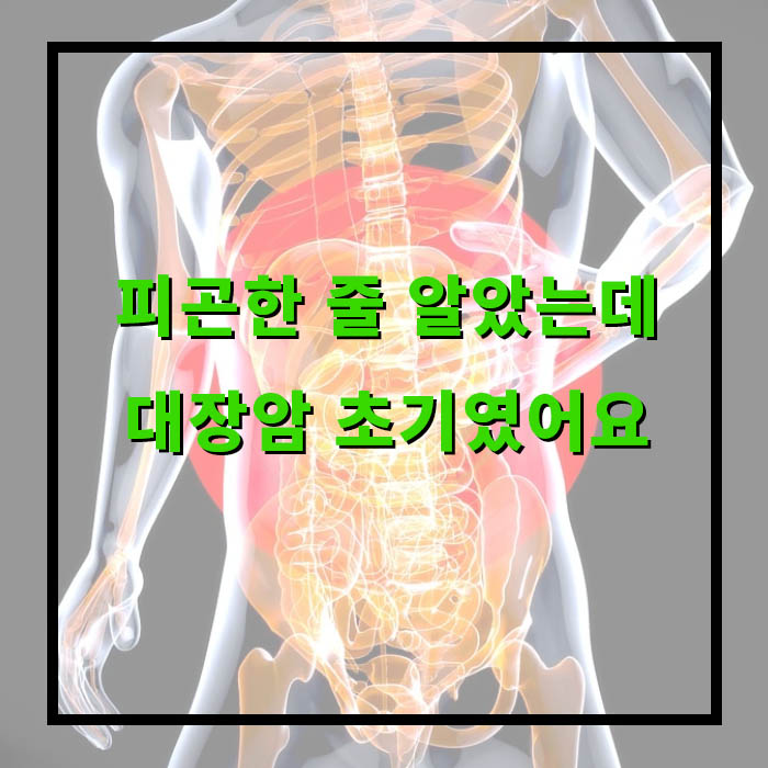 대장암 초기증상, 예방수칙