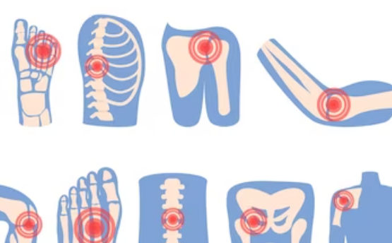류마티스 관절염의 증상2