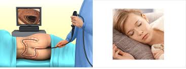 대장내시경 비용 총정리