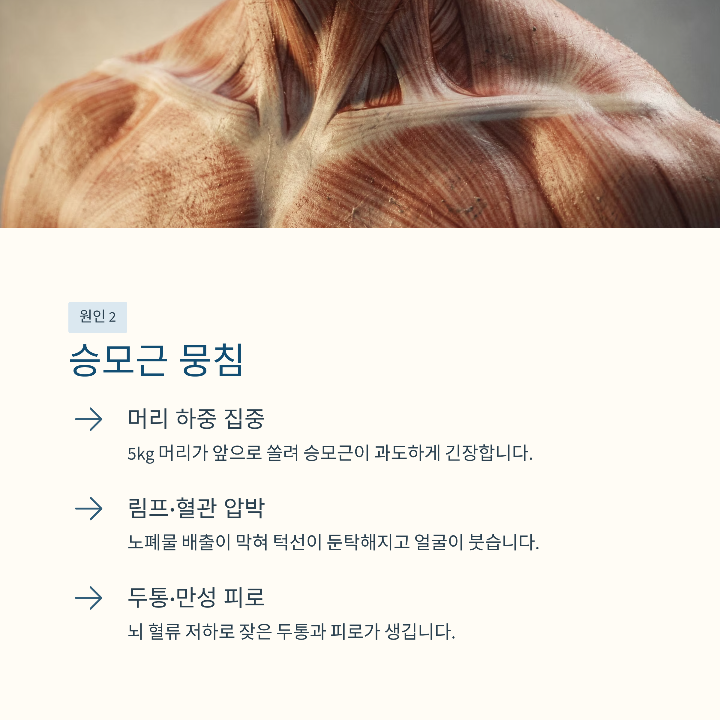 승모근 뭉침