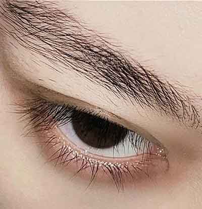 눈떨림 현상 