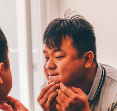 여드름 빨리 없애는 법 원인 증상