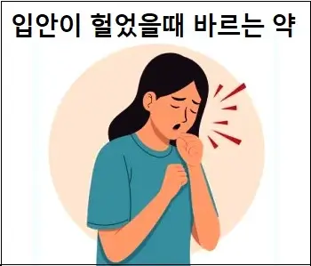 입안이 헐었을때 바르는 약