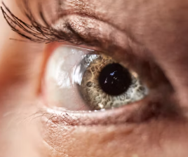 녹내장 치료법 진단 기준 합병증