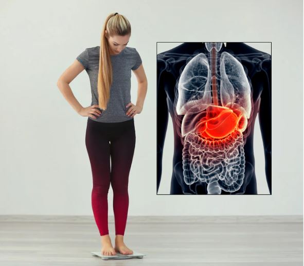 무리한 다이어트로 장내 유익균이 감소한 모습을 표현한 이미지