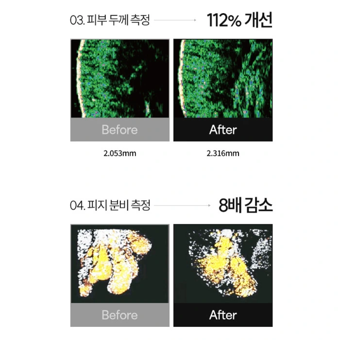 더시드 모공픽서 내돈내산 후기 사용법 효과 부작용 가격