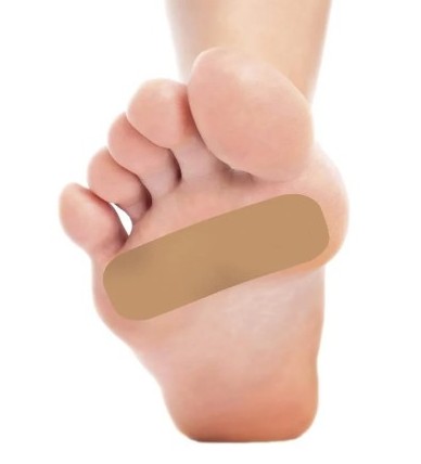 [물집치료방법] 물집생기는 이유, 물집 생겼을때 연고 밴드, 물집 터트리기