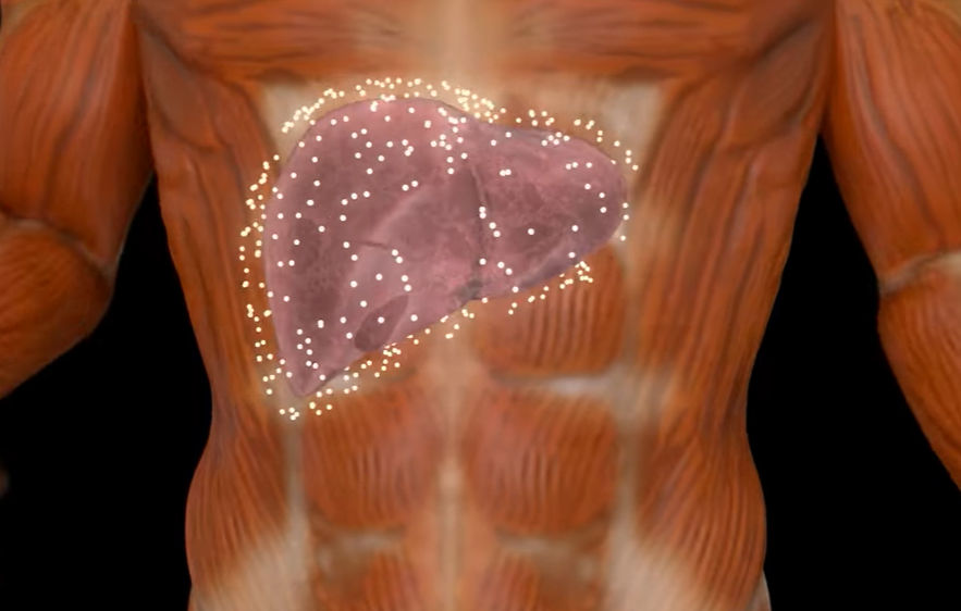 지방간 없애는 방법