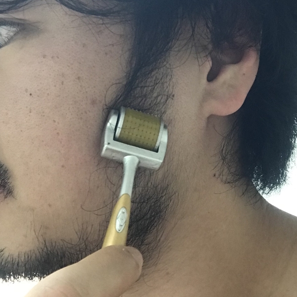 수염 밀도를 높이기 위해 ZGTS 더마롤러 0.5mm로 볼 부위를 집중적으로 롤링하는 모습