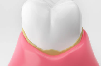 입냄새 심한 이유 제거 방법 입냄새로 알 수 있는 병 입냄새 제거제 원인 자가진단