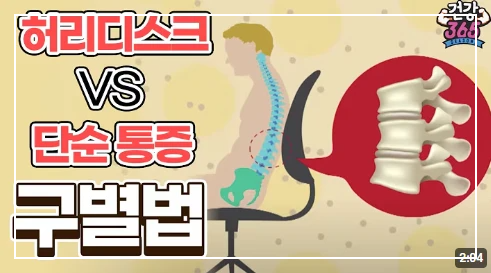 허리가 뻐근하고 땡길 때, 디스크가 아닐 수도