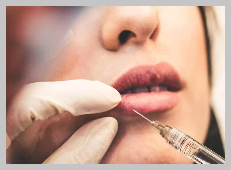 필러 녹이는 주사