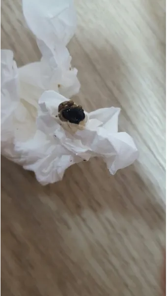 똥이 까만색 검정똥 원인과 질병 가능성_11