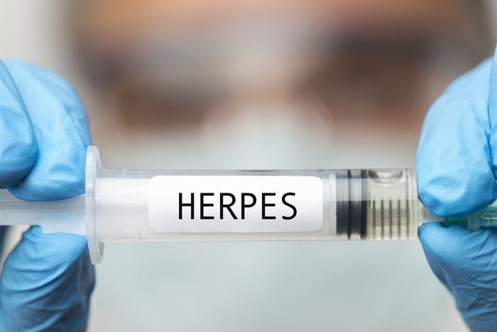 헤르페스 2형 바이러스 증상