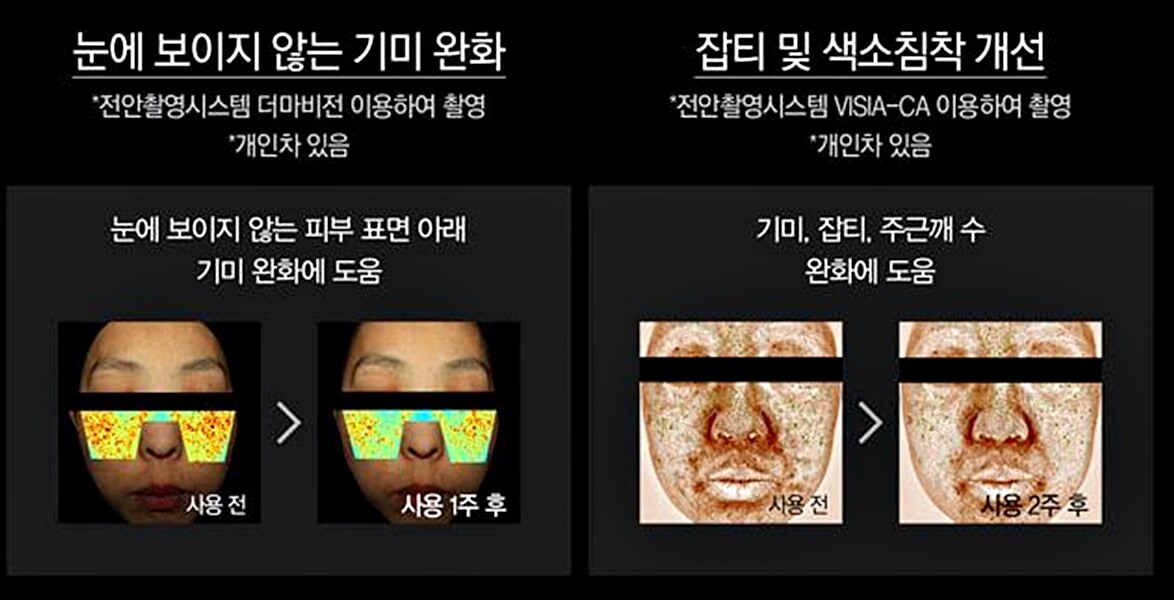 도미나스 크림 후기 : 도미나 크림과 사용법 차이