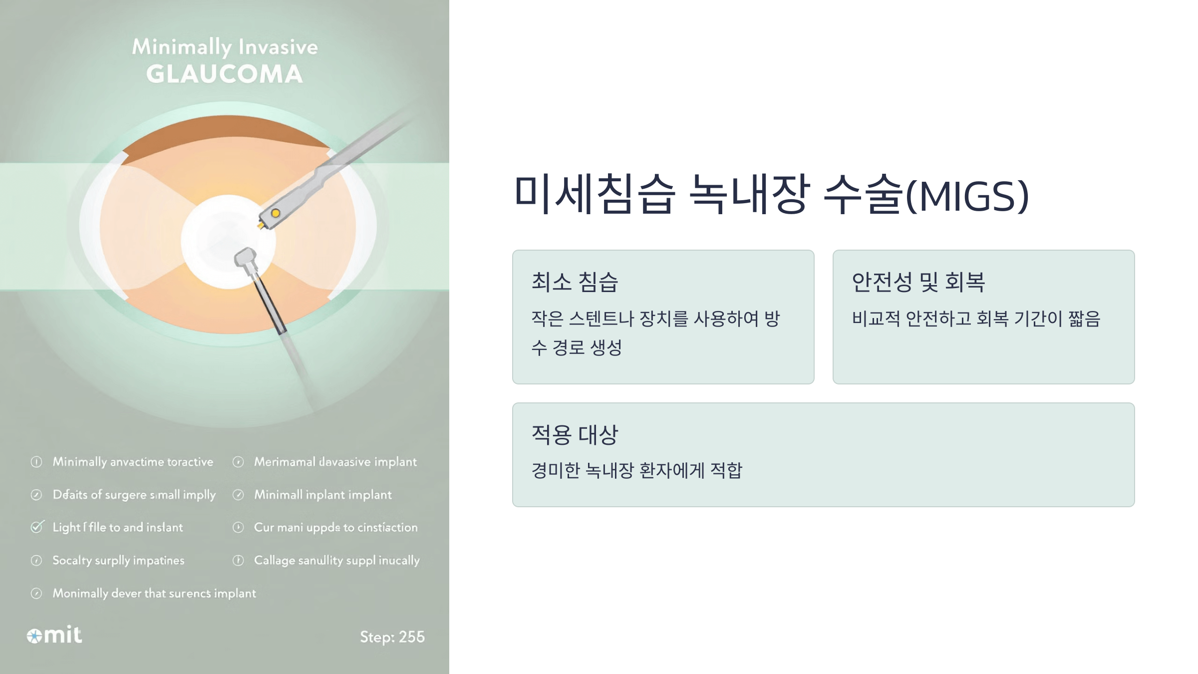 녹내장과 관련된 사진입니다.