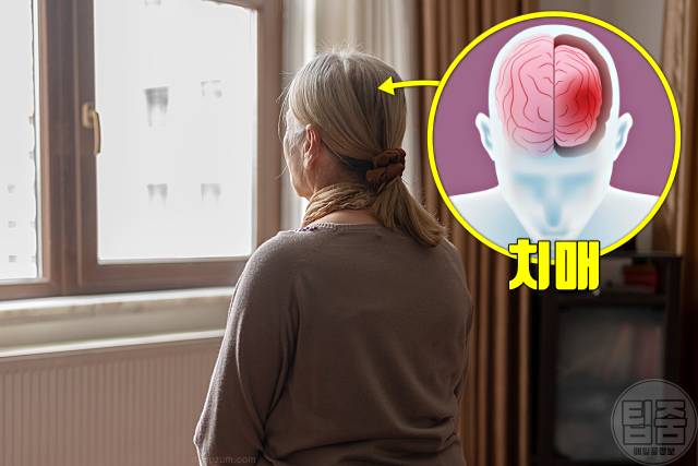 모계유전 질병 알츠하이머 치매