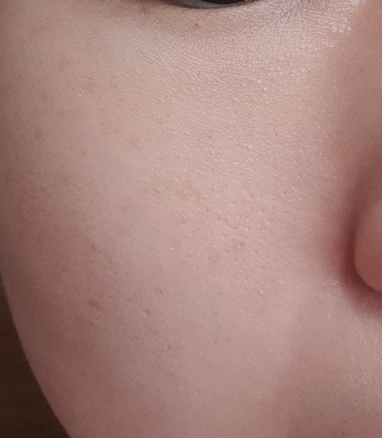 파우더 사용 직후(왼쪽 뺨)