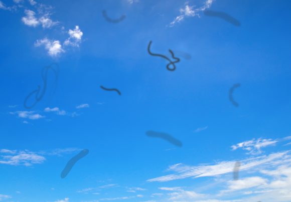 눈에 날파리 현상-비문증