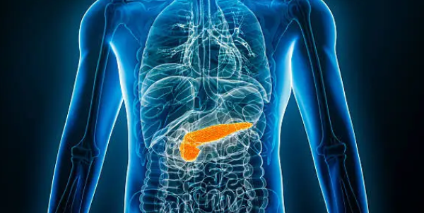 급성 체장염과 관련된 사진