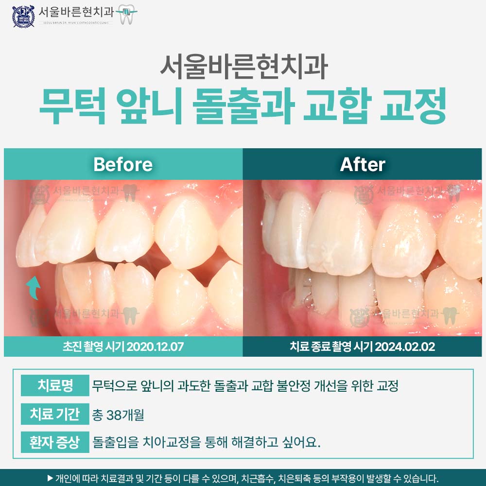 부산해운대교정치과