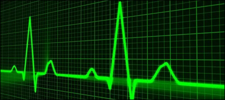 심장 박동 그래프