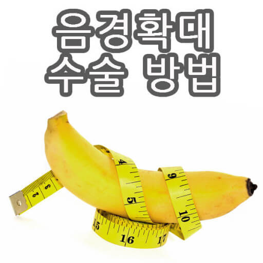 음경확대의 다양한 수술법