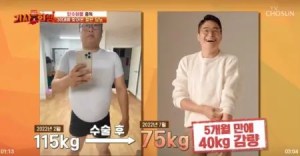 수술 후 체중이 감소하고, 당 수치가 일반인 수준으로 돌아왔다